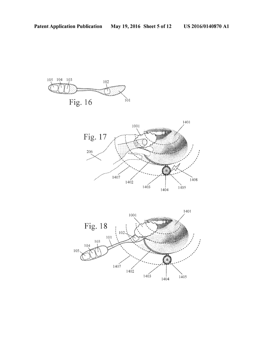 Hand-Held Spectroscopic Sensor with Light-Projected Fiducial Marker for     Analyzing Food Composition and Quantity - diagram, schematic, and image 06