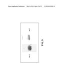 Platelet Protection Solution Having Beta-Galactosidase and Sialidase     Inhibitors diagram and image