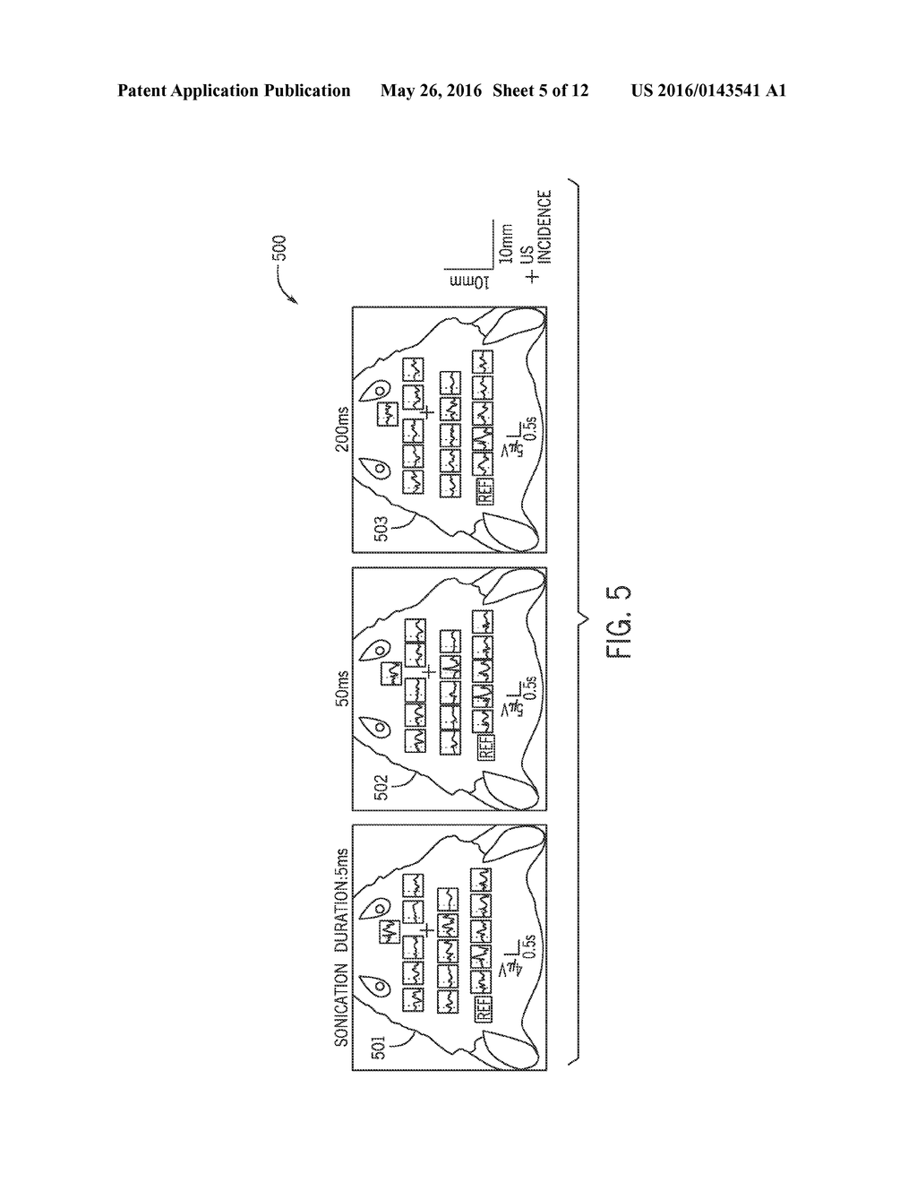 System and Method For Acousto-Electromagnetic Neuroimaging - diagram, schematic, and image 06