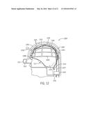 System and Method For Acousto-Electromagnetic Neuroimaging diagram and image