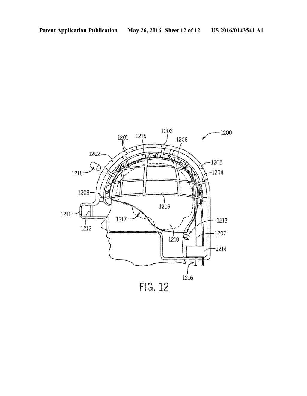 System and Method For Acousto-Electromagnetic Neuroimaging - diagram, schematic, and image 13