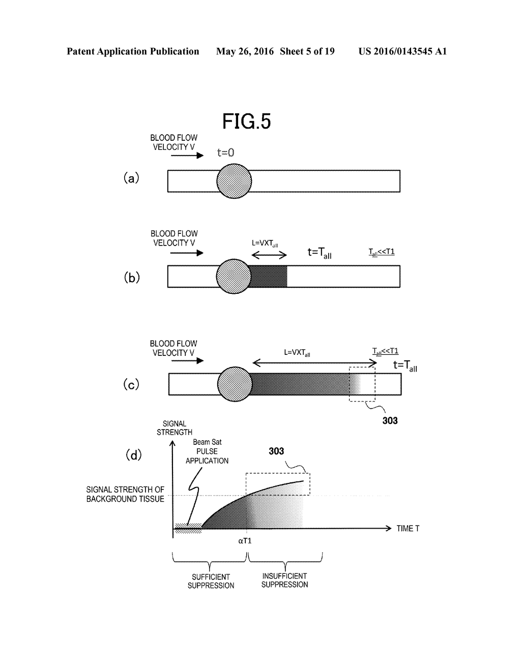 MAGNETIC RESONANCE IMAGING APPARATUS AND MAGNETIC RESONANCE IMAGING METHOD - diagram, schematic, and image 06