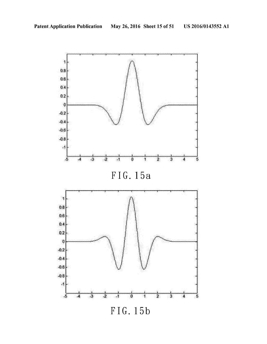 ELECTROCARDIOGRAPHY SIGNAL EXTRACTION METHOD - diagram, schematic, and image 16