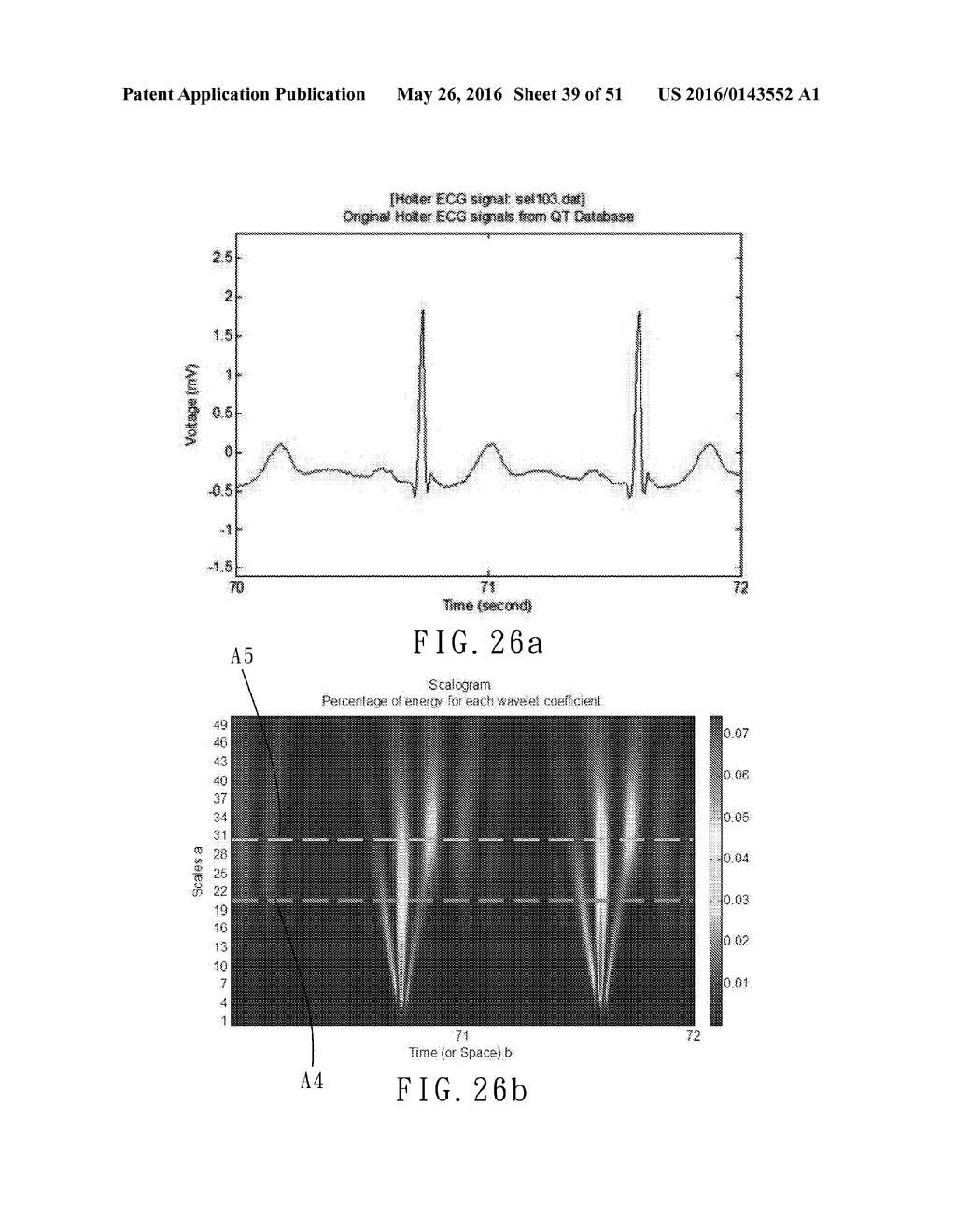 ELECTROCARDIOGRAPHY SIGNAL EXTRACTION METHOD - diagram, schematic, and image 40