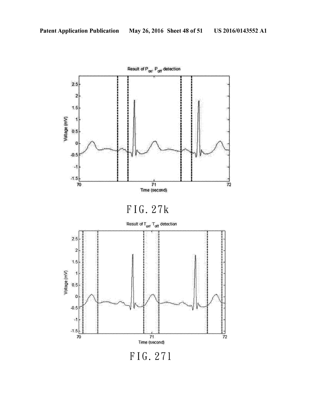 ELECTROCARDIOGRAPHY SIGNAL EXTRACTION METHOD - diagram, schematic, and image 49