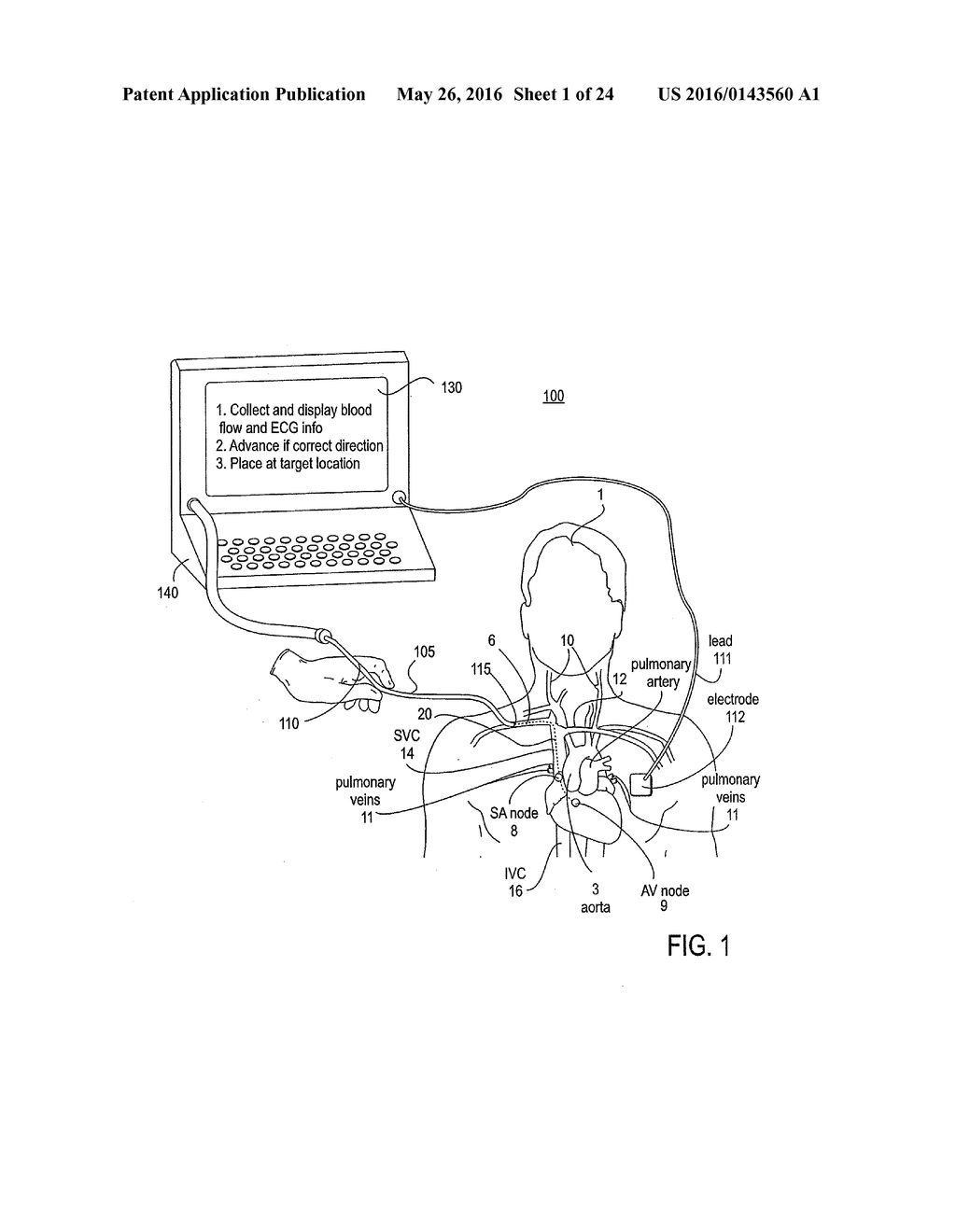 APPARATUS AND METHOD FOR ENDOVASCULAR DEVICE GUIDING AND POSITIONING USING     PHYSIOLOGICAL PARAMETERS - diagram, schematic, and image 02