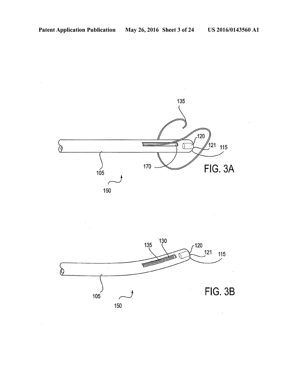 APPARATUS AND METHOD FOR ENDOVASCULAR DEVICE GUIDING AND POSITIONING USING     PHYSIOLOGICAL PARAMETERS - diagram, schematic, and image 04