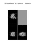 TECHNOLOGIES FOR WHITE MATTER HYPERINTENSITY QUANTIFICATION diagram and image