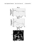 ACNE-AFFECTED SKIN DETERMINATION METHOD AND ACNE-AFFECTED SKIN     DETERMINATION DEVICE diagram and image