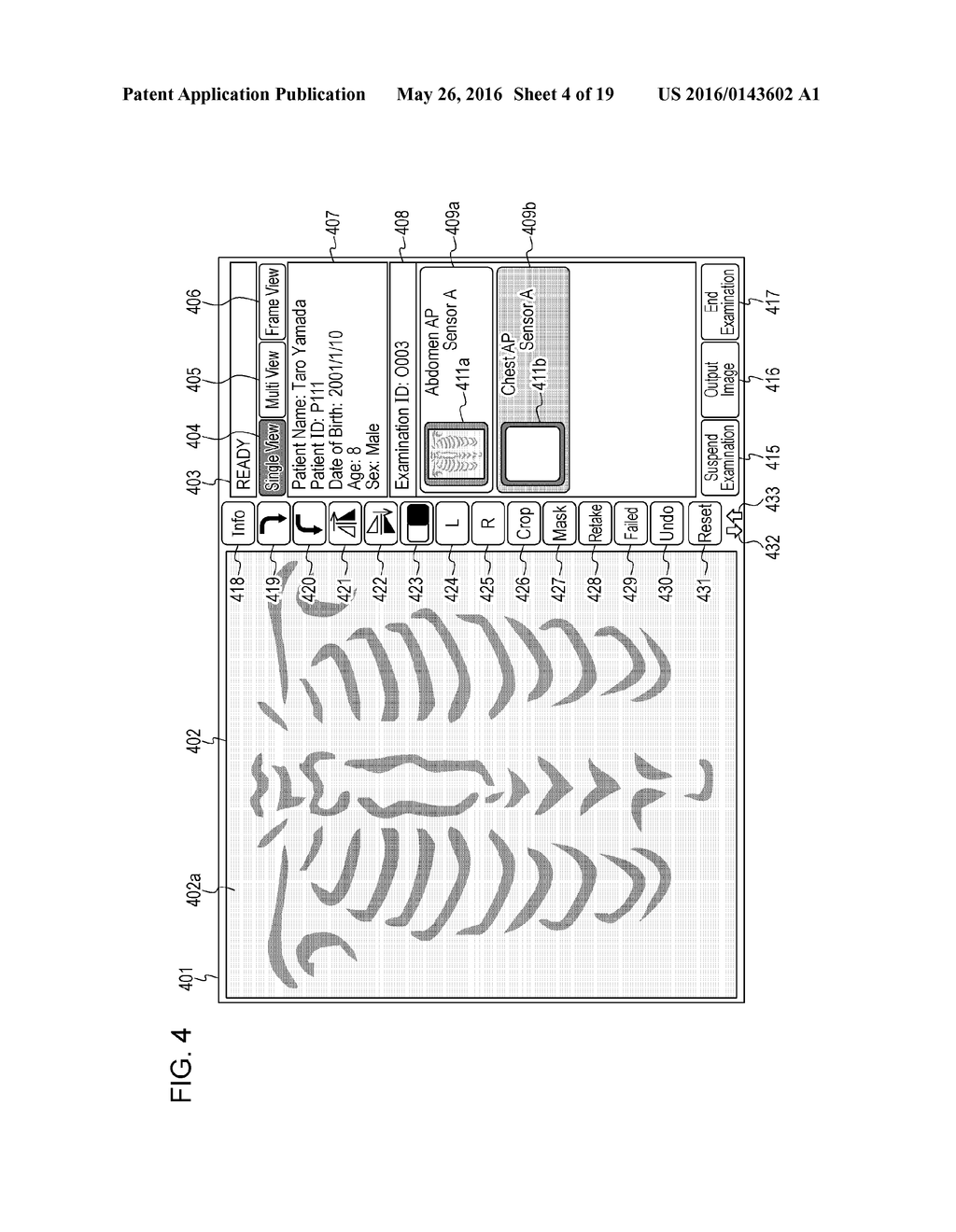 IMAGING INFORMATION PROCESSING APPARATUS, X-RAY IMAGING APPARATUS, X-RAY     IMAGING SYSTEM, CONTROL METHOD, AND PROGRAM FOR CAUSING COMPUTER TO     EXECUTE CONTROL METHOD - diagram, schematic, and image 05