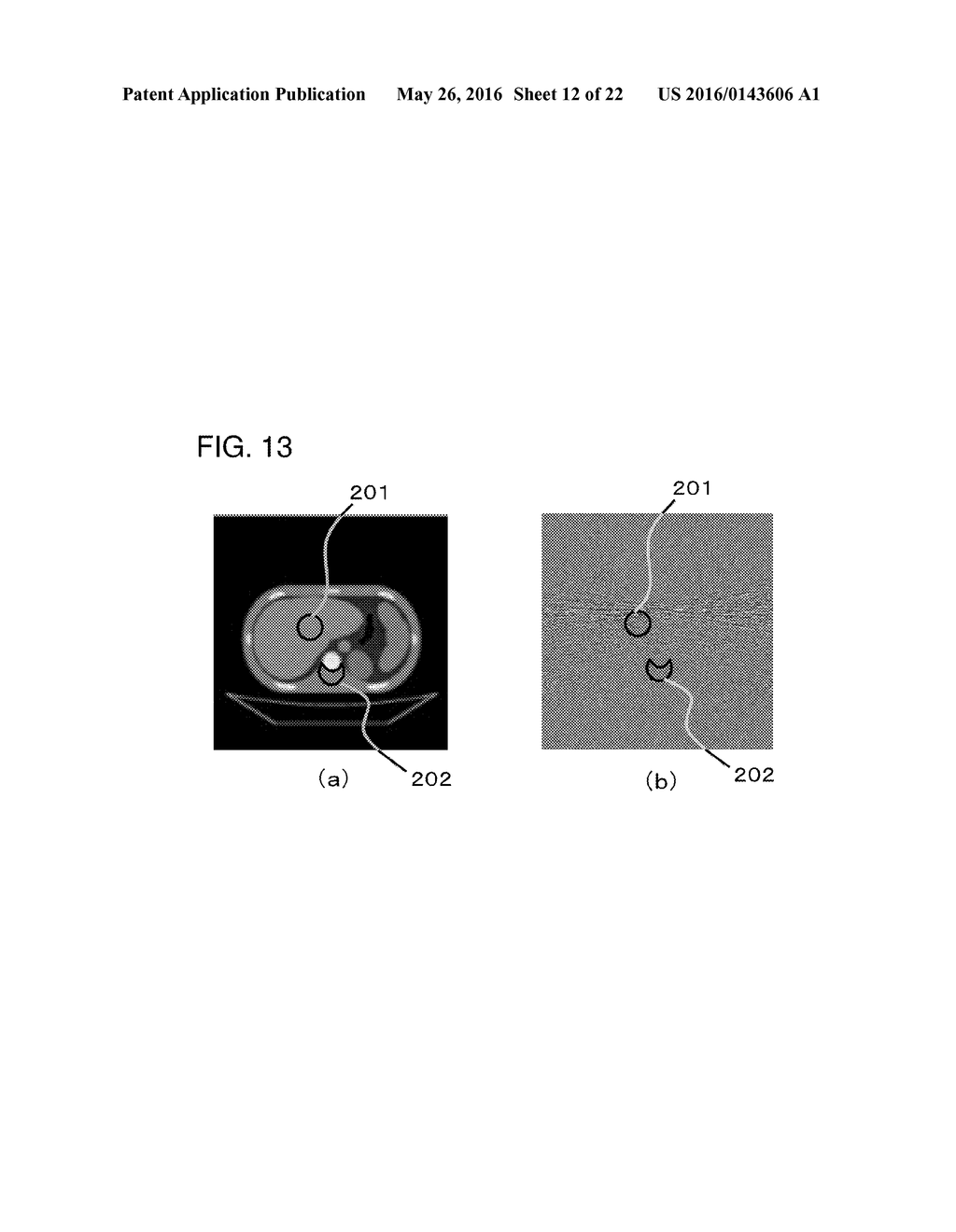 X-RAY CT APPARATUS - diagram, schematic, and image 13