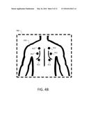 METHOD, SYSTEM AND DEVICE FOR AUSCULTATION diagram and image