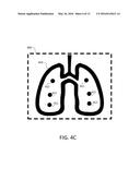 METHOD, SYSTEM AND DEVICE FOR AUSCULTATION diagram and image