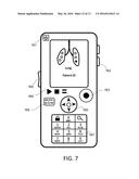 METHOD, SYSTEM AND DEVICE FOR AUSCULTATION diagram and image