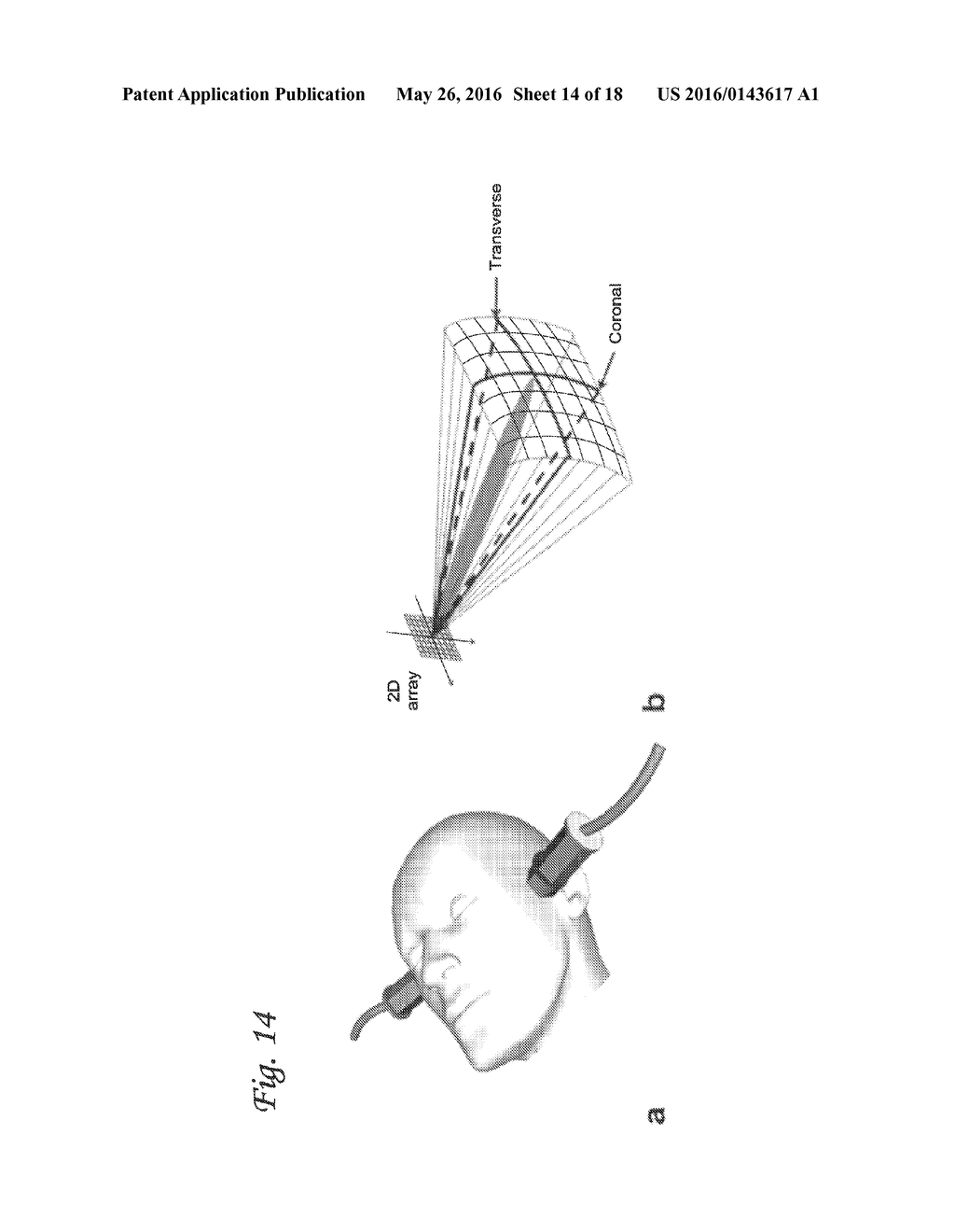 ULTRASOUND IMAGE FORMATION AND/OR RECONSTRUCTION USING MULTIPLE FREQUENCY     WAVEFORMS - diagram, schematic, and image 15