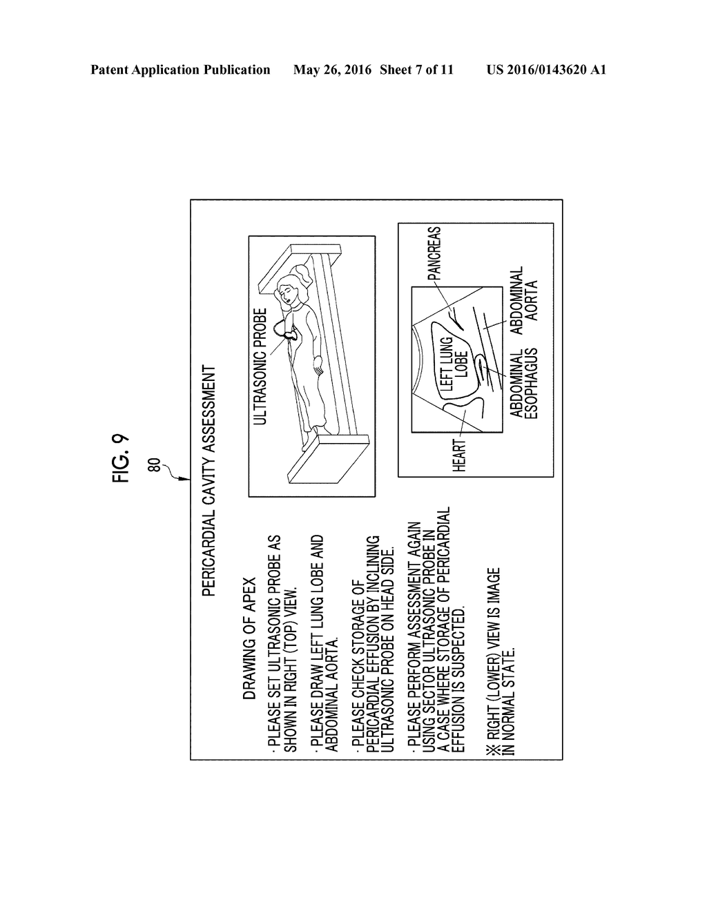 ASSESSMENT ASSISTANCE DEVICE - diagram, schematic, and image 08