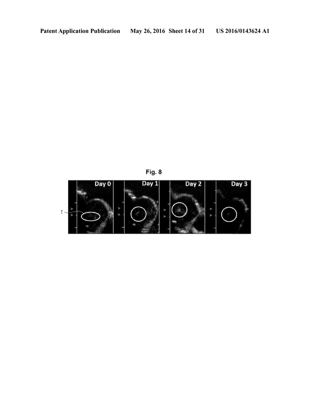 PROBE, ULTRASOUND IMAGING APPARATUS AND CONTROLLING METHOD OF THE     ULTRASOUND IMAGING APPARATUS - diagram, schematic, and image 15