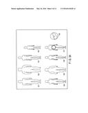 ULTRASONIC DIAGNOSTIC APPARATUS diagram and image