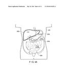 ULTRASONIC DIAGNOSTIC APPARATUS diagram and image