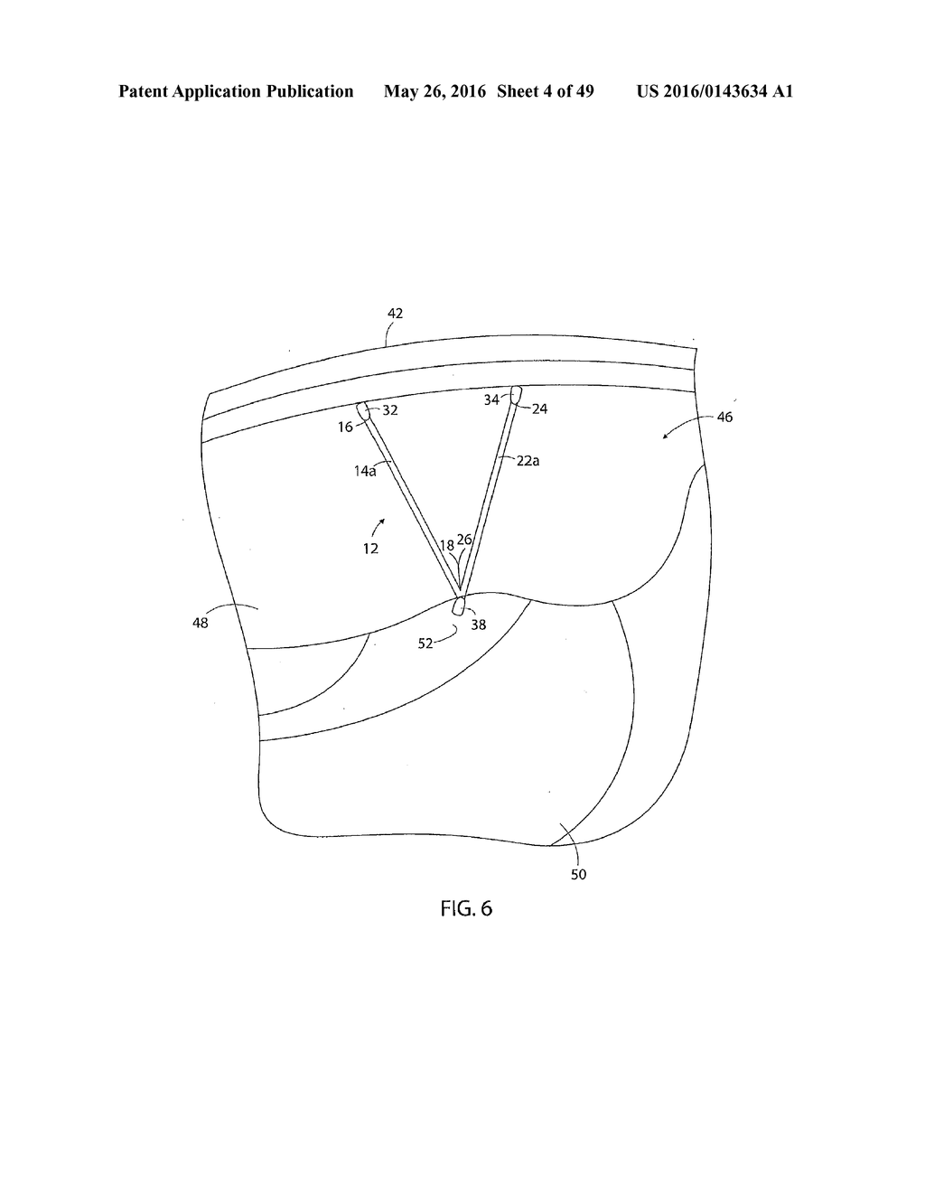 System for Intra-Abdominally Moving an Organ - diagram, schematic, and image 05