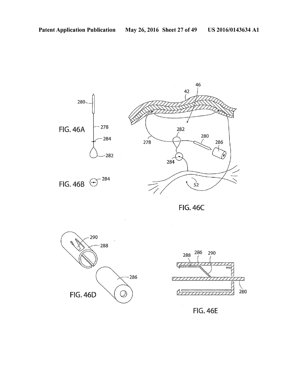 System for Intra-Abdominally Moving an Organ - diagram, schematic, and image 28