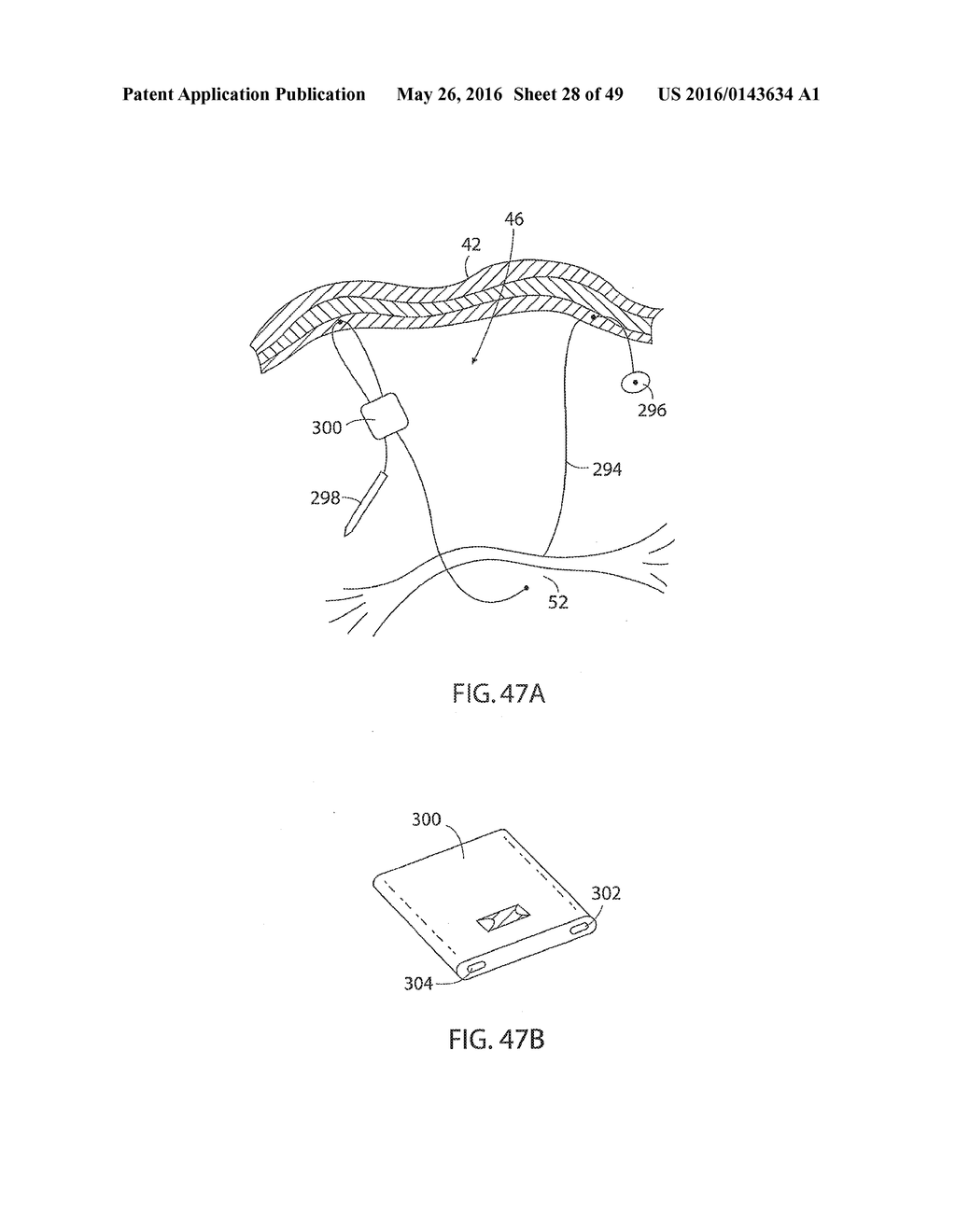 System for Intra-Abdominally Moving an Organ - diagram, schematic, and image 29