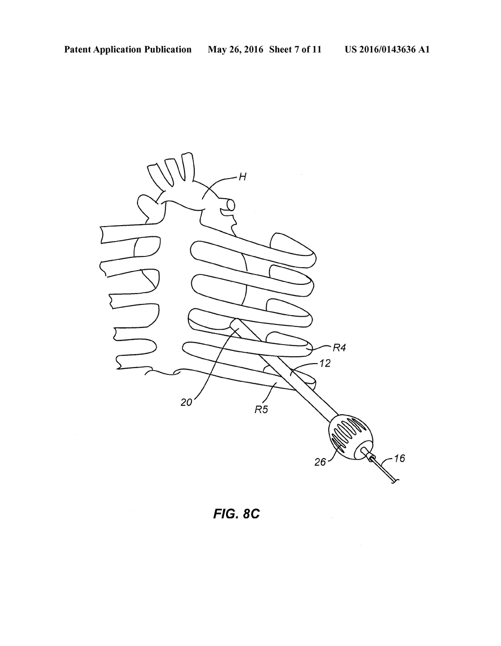 METHOD AND APPARATUS FOR TRANSAPICAL ACCESS AND CLOSURE - diagram, schematic, and image 08