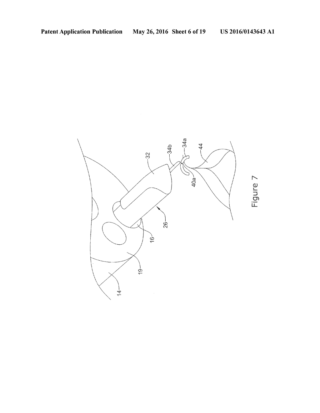 SURGICAL CLOSURE DEVICES INCLUDING A STAPLING MEMBER - diagram, schematic, and image 07