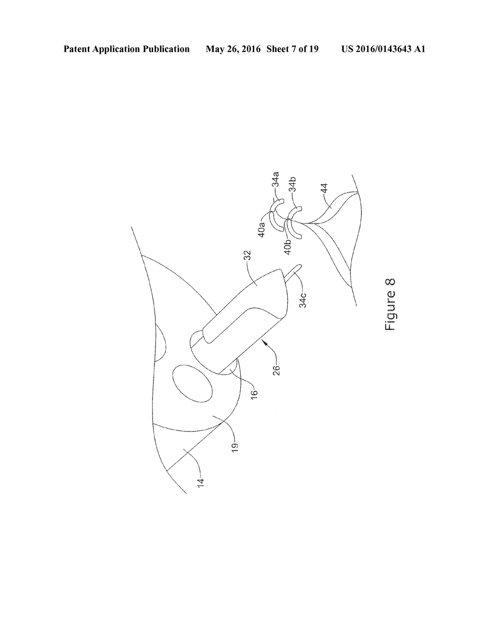 SURGICAL CLOSURE DEVICES INCLUDING A STAPLING MEMBER - diagram, schematic, and image 08