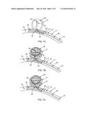 CATHETER TIP TO AID FILAMENT DELIVERY diagram and image