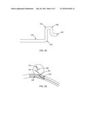 CATHETER TIP TO AID FILAMENT DELIVERY diagram and image