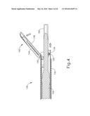 ULTRASONIC SURGICAL INSTRUMENT WITH BLADE COOLING THROUGH RETRACTION diagram and image