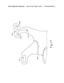 ULTRASONIC SURGICAL INSTRUMENT WITH BLADE COOLING THROUGH RETRACTION diagram and image