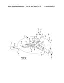 RETRACTABLE BURR HOLE PLATE AND METHOD diagram and image