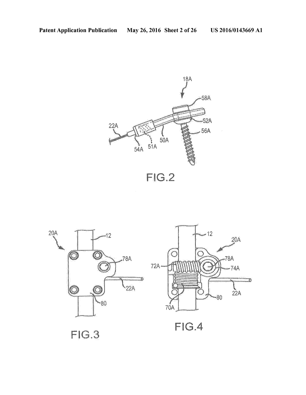 SPINAL CORRECTION SYSTEM ACTUATORS - diagram, schematic, and image 03