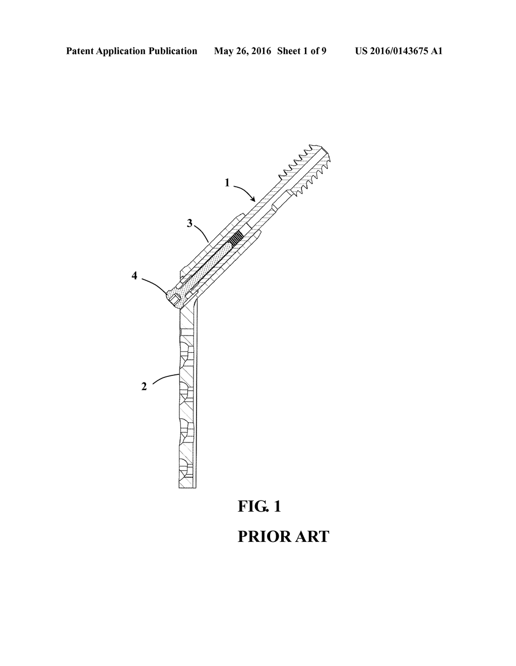 REAR-RETAINING STRUCTURE FOR DYNAMIC HIP SCREW - diagram, schematic, and image 02