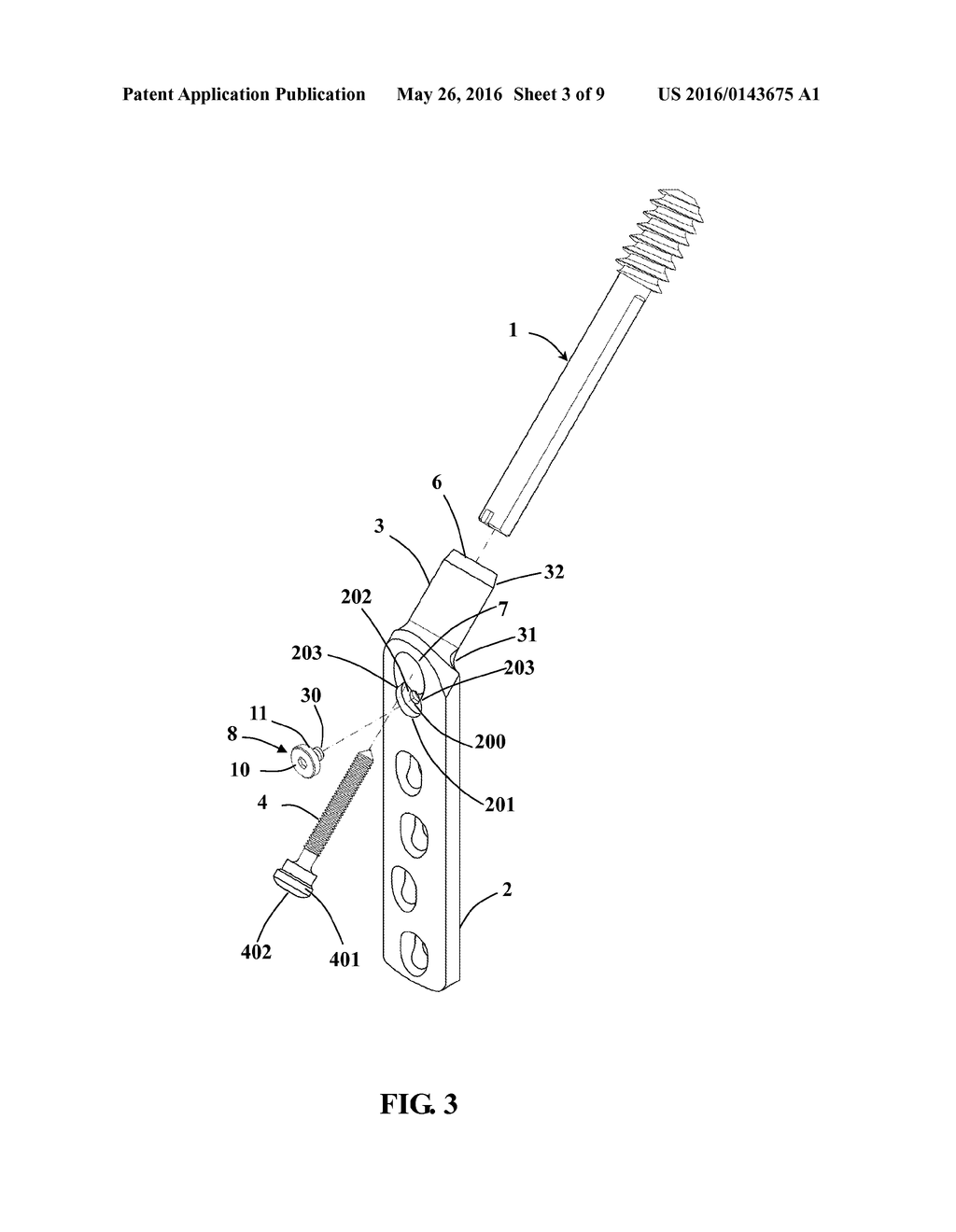 REAR-RETAINING STRUCTURE FOR DYNAMIC HIP SCREW - diagram, schematic, and image 04