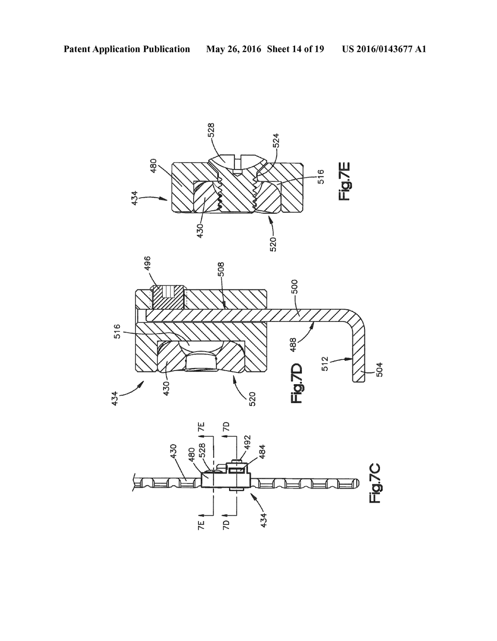 Orthognathic Implant and Methods of Use - diagram, schematic, and image 15