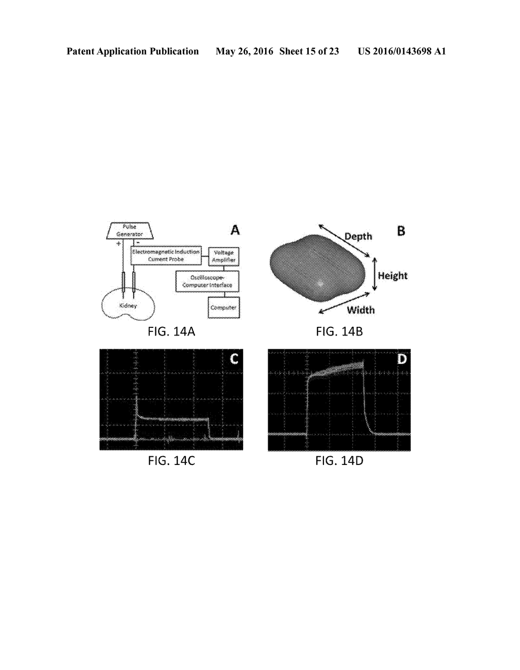 SYSTEM AND METHOD FOR ESTIMATING A TREATMENT VOLUME FOR ADMINISTERING     ELECTRICAL-ENERGY BASED THERAPIES - diagram, schematic, and image 16