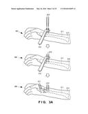 SURGICAL OPERATION SUPPORT SYSTEM, SURGICAL OPERATION SUPPORT APPARATUS,     SURGICAL OPERATION SUPPORT METHOD, SURGICAL OPERATION SUPPORT PROGRAM,     AND INFORMATION PROCESSING APPARATUS diagram and image