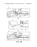 SURGICAL OPERATION SUPPORT SYSTEM, SURGICAL OPERATION SUPPORT APPARATUS,     SURGICAL OPERATION SUPPORT METHOD, SURGICAL OPERATION SUPPORT PROGRAM,     AND INFORMATION PROCESSING APPARATUS diagram and image