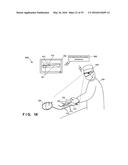 SURGICAL OPERATION SUPPORT SYSTEM, SURGICAL OPERATION SUPPORT APPARATUS,     SURGICAL OPERATION SUPPORT METHOD, SURGICAL OPERATION SUPPORT PROGRAM,     AND INFORMATION PROCESSING APPARATUS diagram and image