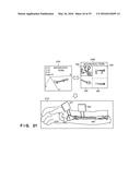 SURGICAL OPERATION SUPPORT SYSTEM, SURGICAL OPERATION SUPPORT APPARATUS,     SURGICAL OPERATION SUPPORT METHOD, SURGICAL OPERATION SUPPORT PROGRAM,     AND INFORMATION PROCESSING APPARATUS diagram and image