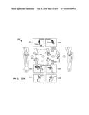 SURGICAL OPERATION SUPPORT SYSTEM, SURGICAL OPERATION SUPPORT APPARATUS,     SURGICAL OPERATION SUPPORT METHOD, SURGICAL OPERATION SUPPORT PROGRAM,     AND INFORMATION PROCESSING APPARATUS diagram and image