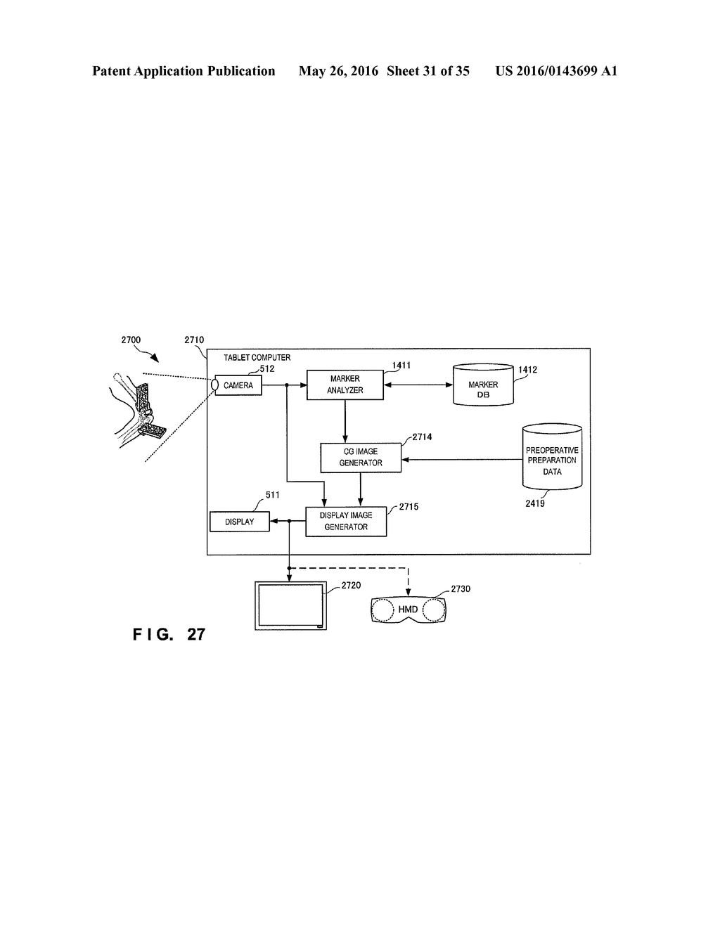 SURGICAL OPERATION SUPPORT SYSTEM, SURGICAL OPERATION SUPPORT APPARATUS,     SURGICAL OPERATION SUPPORT METHOD, SURGICAL OPERATION SUPPORT PROGRAM,     AND INFORMATION PROCESSING APPARATUS - diagram, schematic, and image 32