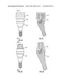 FIXED HYBRID DENTAL ATTACHMENT ASSEMBLY AND METHODS OF USE diagram and image