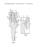 FIXED HYBRID DENTAL ATTACHMENT ASSEMBLY AND METHODS OF USE diagram and image