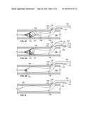 TEMPORARY FILTER RETRIEVAL APPARATUS AND METHOD diagram and image