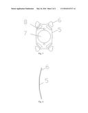 Implantable Myopia Lens and Preparation Method Thereof diagram and image