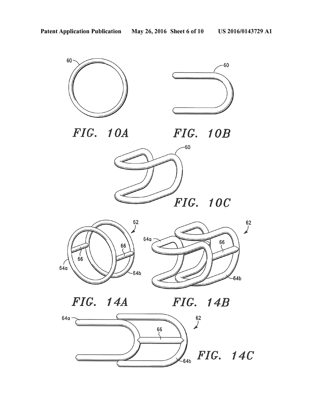 Regenerative Respiratory Tract Prostheses - diagram, schematic, and image 07